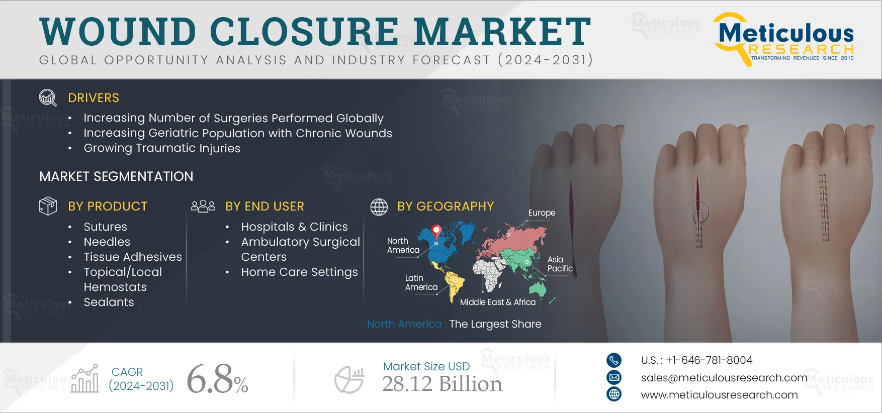Wound Closure Market