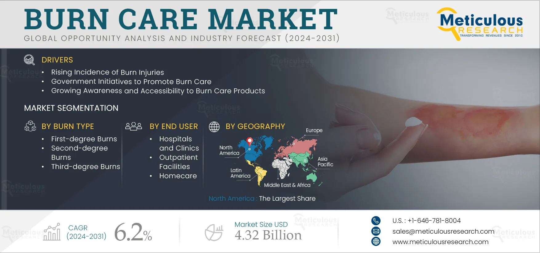 Burn Care Market