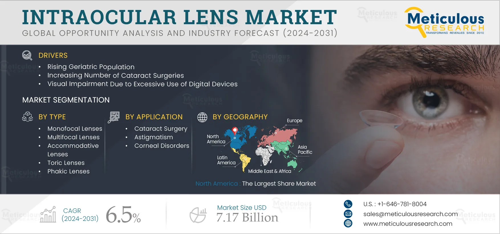 Intraocular Lens Market