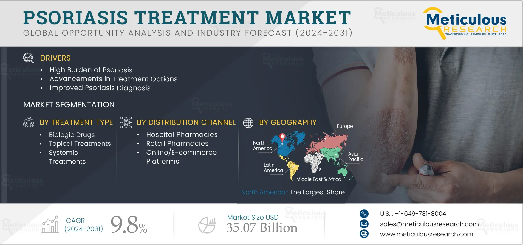 Psoriasis Treatment Market