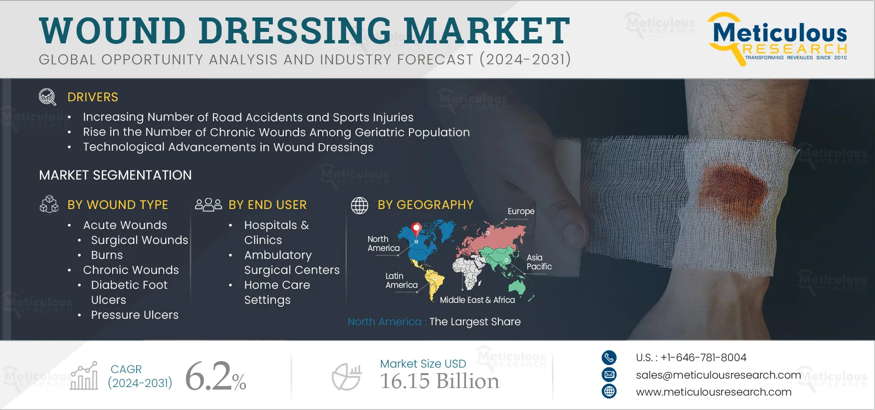 Wound Dressings Market 